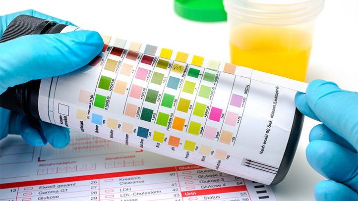 Clinical urine tests